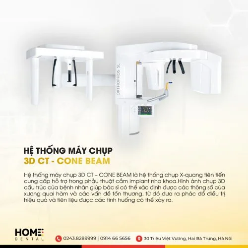 Máy chụp 3D CT - Cone Beam