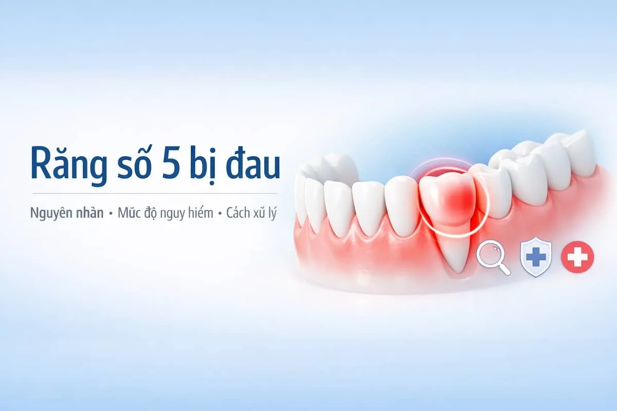 Răng số 5 bị đau: Nguyên nhân, mức độ nguy hiểm & cách xử lý