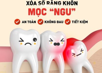 Nhổ răng khôn: Quy trình và các lưu ý