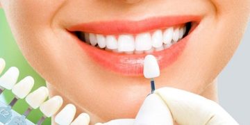 Răng sứ ceramill là gì? Có tốt không? Giá bao nhiêu?