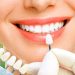 Răng sứ ceramill là gì? Có tốt không? Giá bao nhiêu? 3 Răng sứ ceramill là gì? Có tốt không? Giá bao nhiêu?