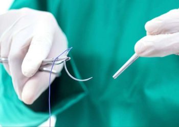 Cần cắt chỉ răng khôn sau nhổ bao lâu?