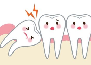 Nhổ răng khôn xong bị đau răng bên cạnh thì nên làm gì?