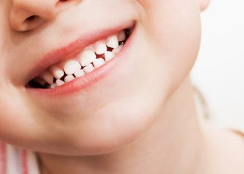 Trẻ 12 tuổi còn thay răng không?