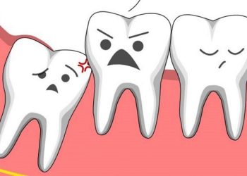 Có phải ai cũng mọc răng khôn?