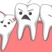 Có phải ai cũng mọc răng khôn? 19 Có phải ai cũng mọc răng khôn?