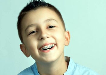 Niềng Răng Cho Trẻ 12 Tuổi Giá Bao Nhiêu?