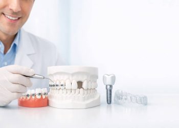 Mất Răng Số 5 Có Niềng Được Không? Giải Pháp Tối Ưu Nhất