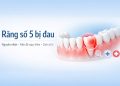 Răng số 5 bị đau: Nguyên nhân, mức độ nguy hiểm & cách xử lý