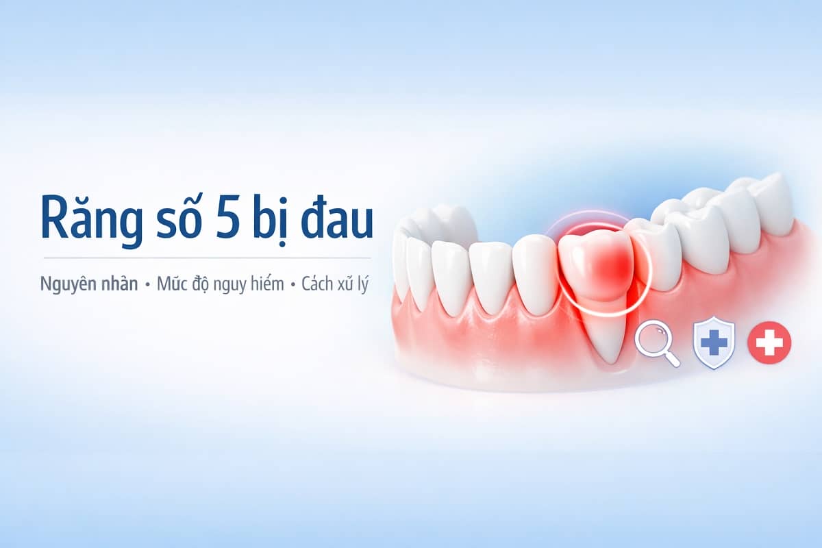 Răng số 5 bị đau: Nguyên nhân, mức độ nguy hiểm & cách xử lý