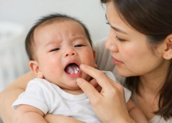 Trẻ sơ sinh nổi đẹn trong miệng: Nguyên nhân & cách trị nhanh